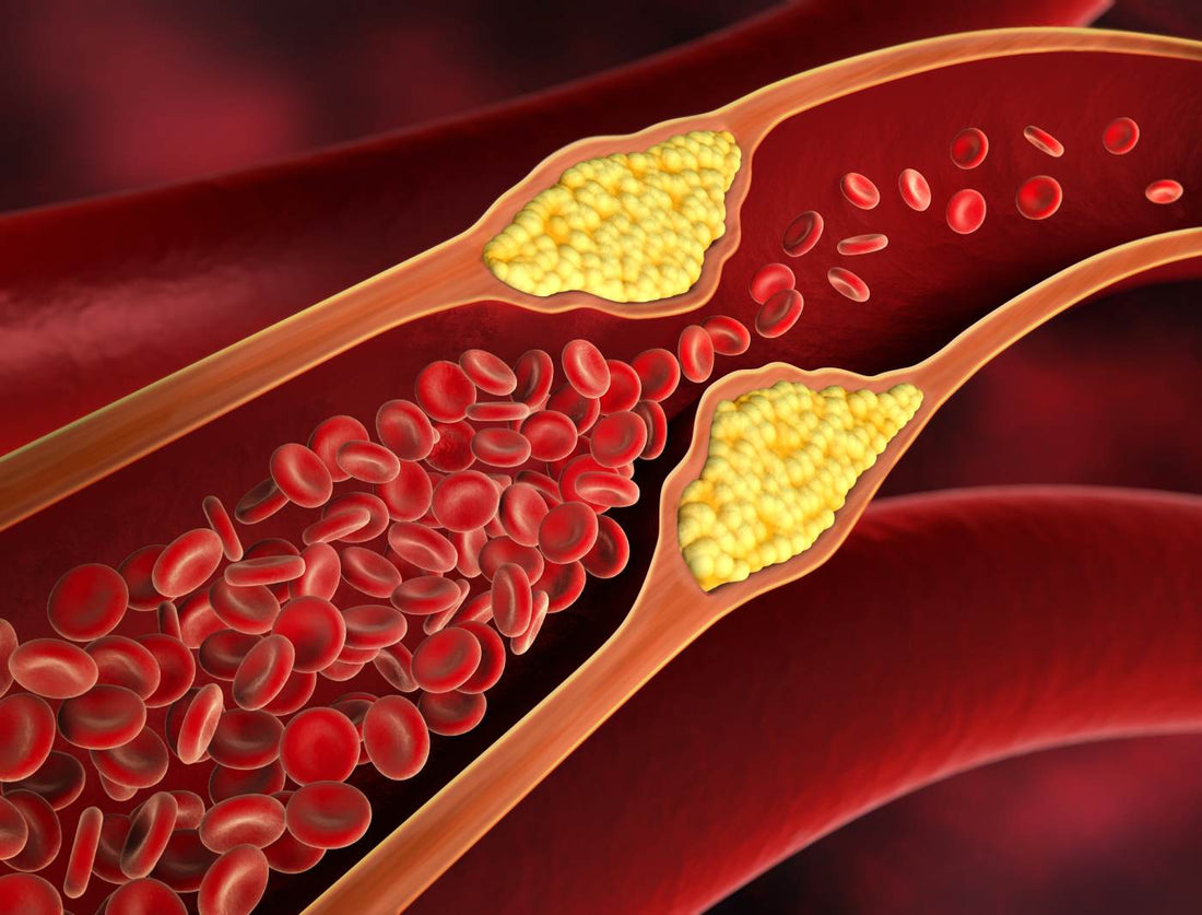 Cholesterol: Friend or Foe? Understanding the Impact on Your Health