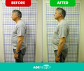 AgeRelief - Instant Relief From Sciatica & Lower Back Pain